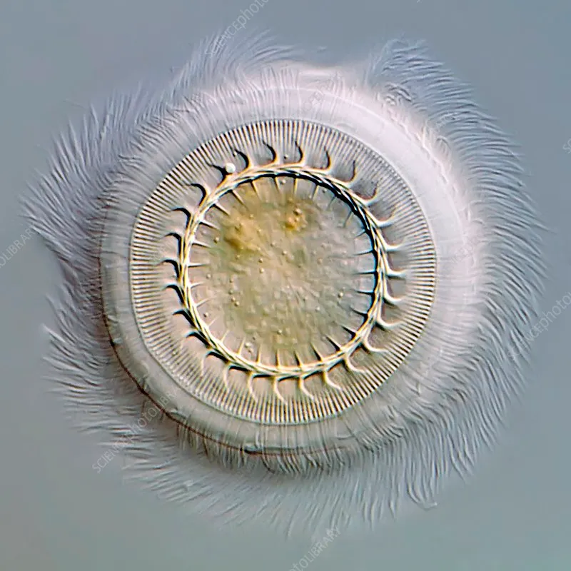 Trichodina under microscope